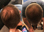 ⁦Watermans Grow Me Shampoo 3 Months - شامبو جرومي 3 شهور | علاج لتساقط الشعر وتعزيز النمو⁩ - الصورة ⁦4⁩