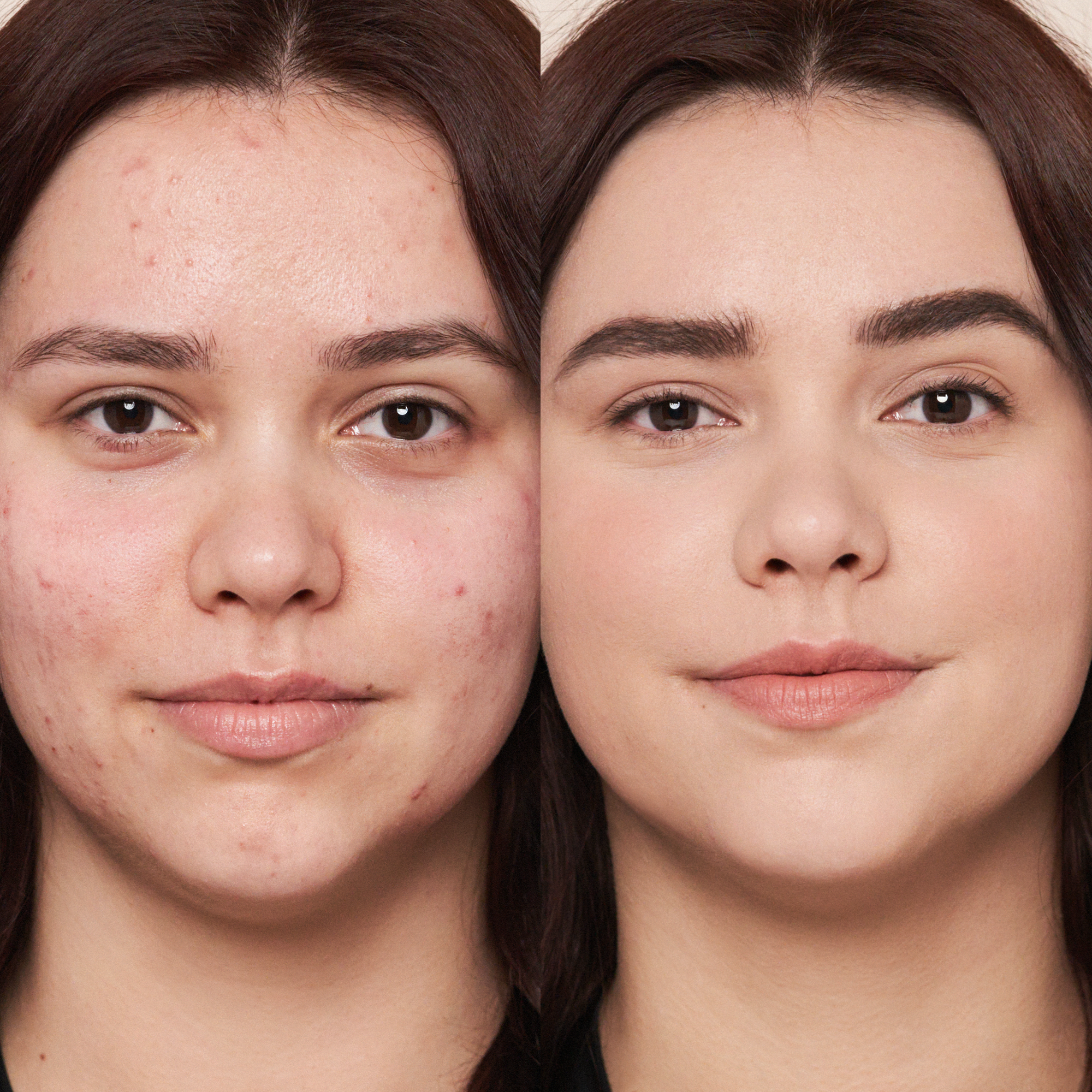 ⁦كريم الأساس ماجيك فينيش موس رقم1 في ألمانيا بلمسه سحريه م.أسام 30 مل⁩ - الصورة ⁦4⁩